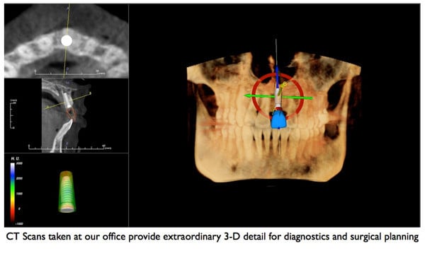 CT Scan example